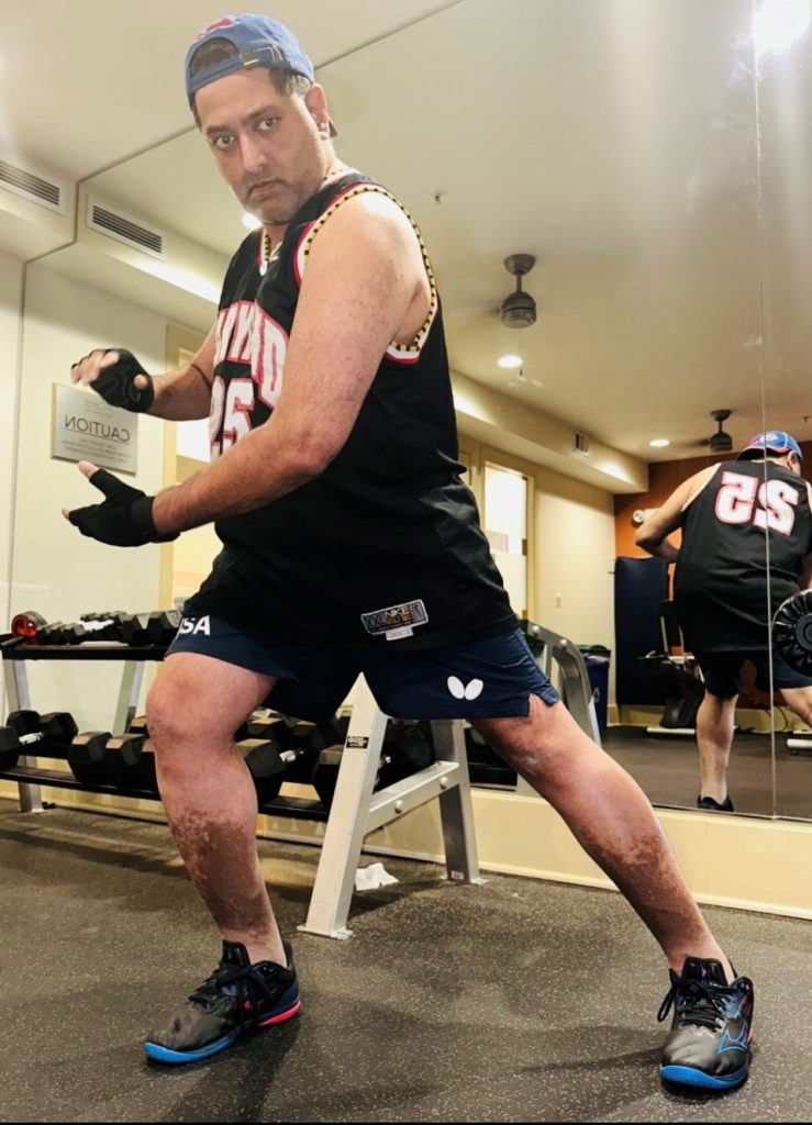 Image of real CREXONT patient, Navin, working out at the gym.